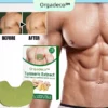 Orgadeco™ Gynecomastia Cellulite Melting Patch