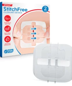 GFOUK™ StitchFree Closure Device