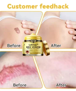 Lotmay™ Bee Venom Skin Treatment Cream