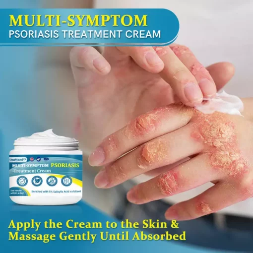 Ourlyard™ Advanced Multi-Symptom Psoriasis Treatment Cream