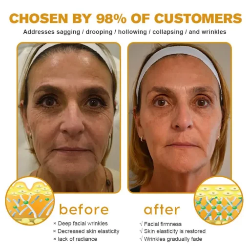 𝐒𝐩𝐳𝐯™ Botox Bee Venom Wrinkle Removal Cream