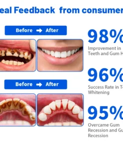 Dobshow™ SmartSmile Bee Venom Whitening & Repair Toothpaste