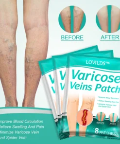 LOVILDS™ Leech Varicose Veins Patch