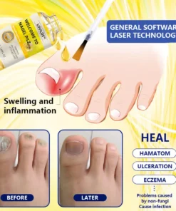 LOVILDS™Wasp Toxin Gray Nail Treatment