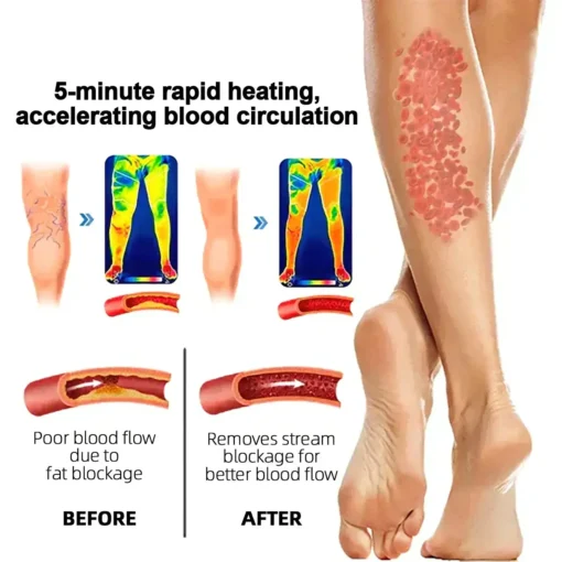 Paiduis™ Radiofrequency Herbal Thermal Knee Support