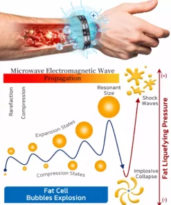 QIAWI™ Pulsed Magnetic Acupressure Bracelet