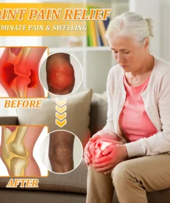 flysmus™ Bee Venom Advanced Pain-Relief & Bone Healing Cream