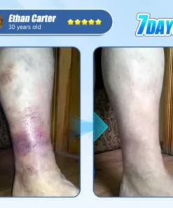 ADFIRE® Diabetic Skin Revolution – 6-IN-1 Clinical Solution